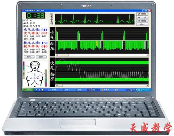 高级心肺复苏模拟人（计算机控制）(图2)